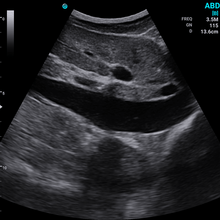 Indlæs billede til gallerivisning SonoEye P5 Konveks Ultralydsscanner - Håndholdt