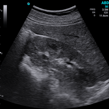Indlæs billede til gallerivisning SonoEye P5 Konveks Ultralydsscanner - Håndholdt