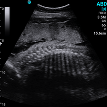 Indlæs billede til gallerivisning SonoEye P5 Konveks Ultralydsscanner - Håndholdt