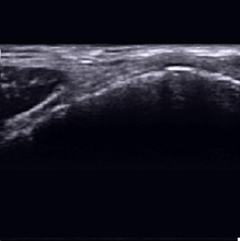 Indlæs billede til gallerivisning SonoEye P2 Lineær Ultralydsscanner - Håndholdt