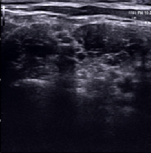 Indlæs billede til gallerivisning SonoEye P2 Lineær Ultralydsscanner - Håndholdt